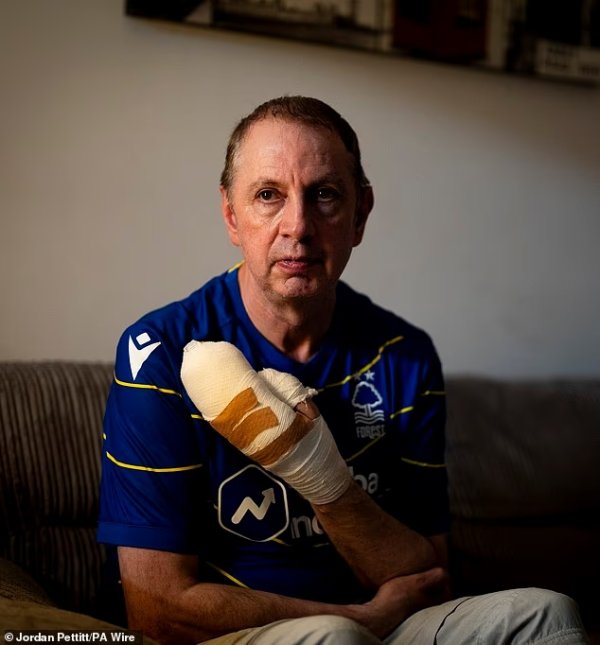 好东谈主有好报！丛林球迷济弱扶倾被砍七刀，俱乐部官方捐钱1万英镑